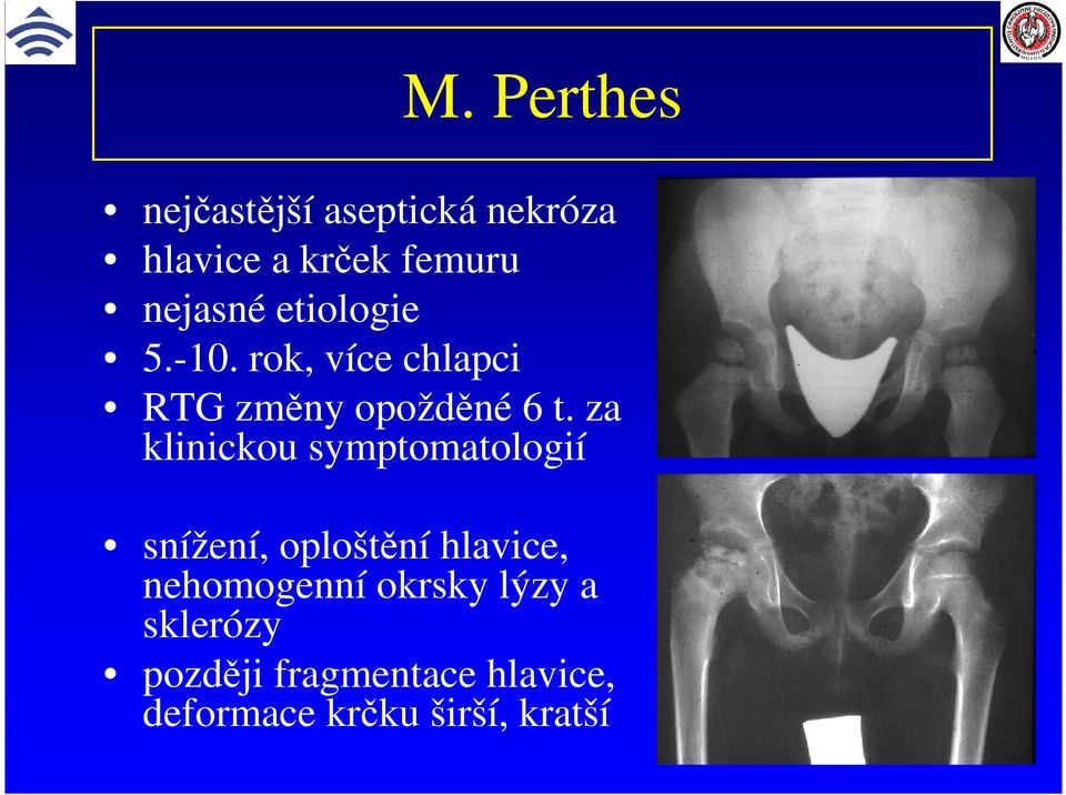 za klinickou symptomatologií snížení, oploštění hlavice, nehomogenní