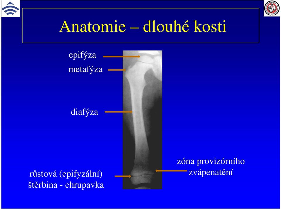 (epifyzální) štěrbina -