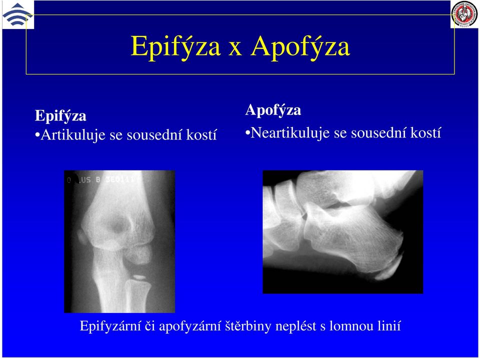 Neartikuluje se sousední kostí