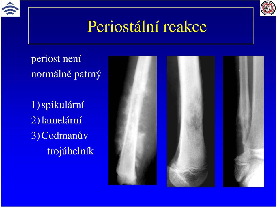 patrný 1) spikulární 2)