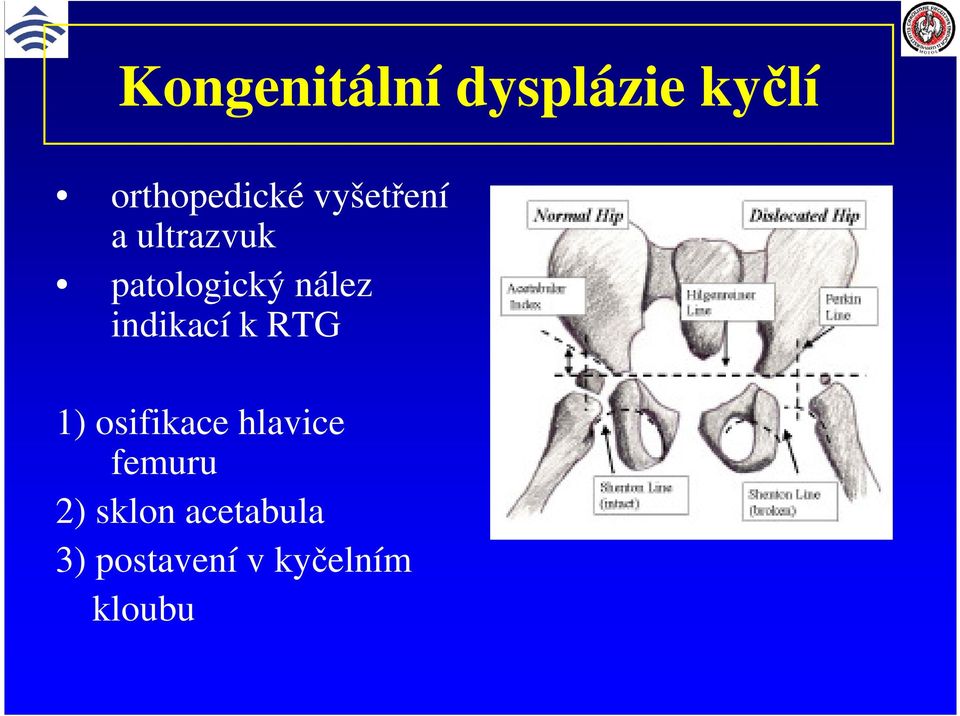 indikací k RTG 1) osifikace hlavice femuru