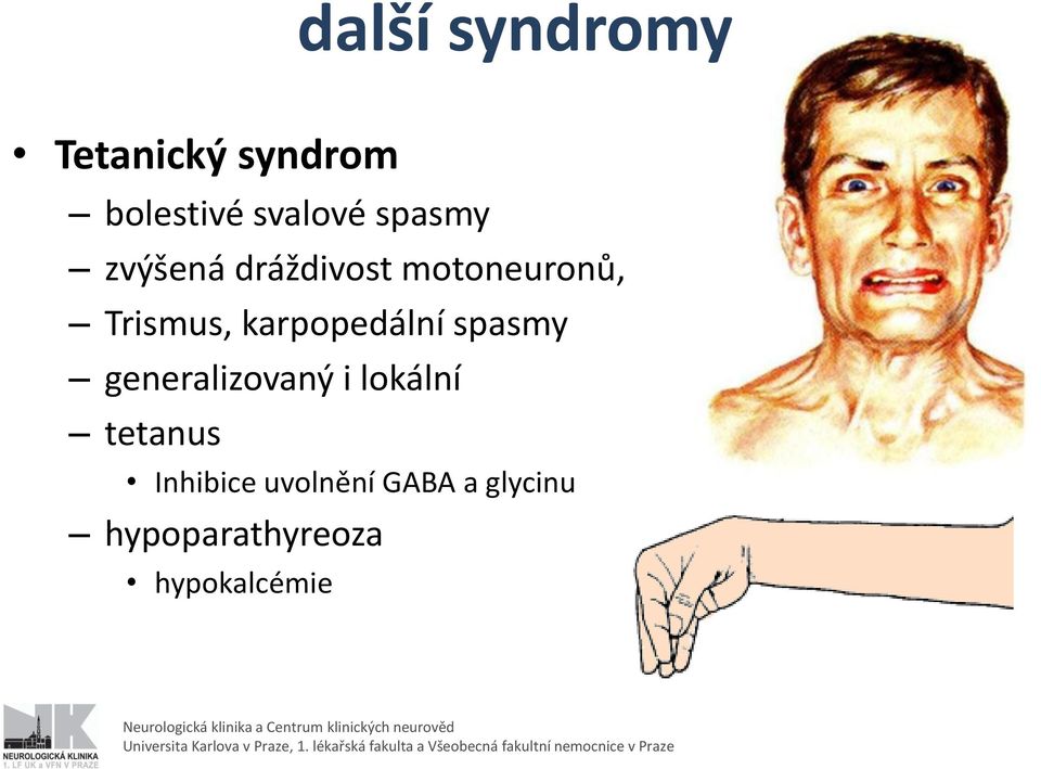 karpopedální spasmy generalizovaný i lokální tetanus