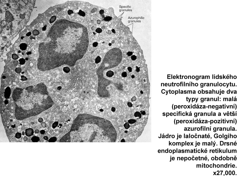 granula a větší (peroxidáza-pozitivní) azurofilní granula.