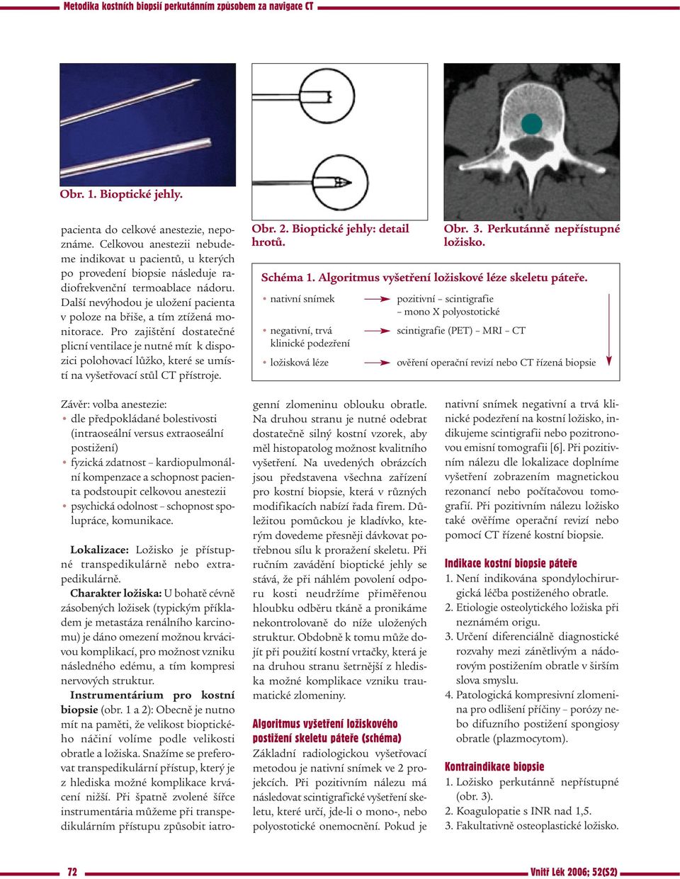 Pro zajištění dostatečné plicní ventilace je nutné mít k dispozici polohovací lůžko, které se umístí na vyšetřovací stůl CT přístroje. Obr. 2. Bioptické jehly: detail hrotů. Obr. 3.