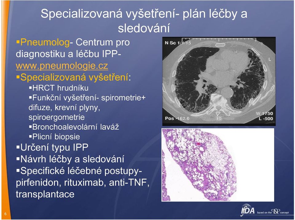 cz Specializovaná vyšetření: HRCT hrudníku Funkční vyšetření- spirometrie+ difuze, krevní