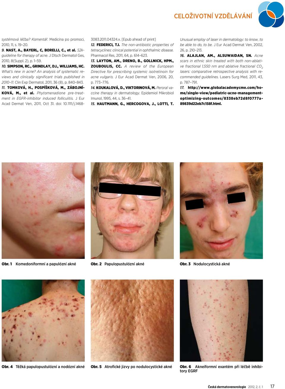 An analysis of systematic reviews and clinically significant trials published in 2010 11. Clin Exp Dermatol, 2011, 36 (8), p. 840 843. 11. TOMKOVÁ, H., POSPÍŠKOVÁ, M., ZÁBOJNÍ- KOVÁ, M., et al.