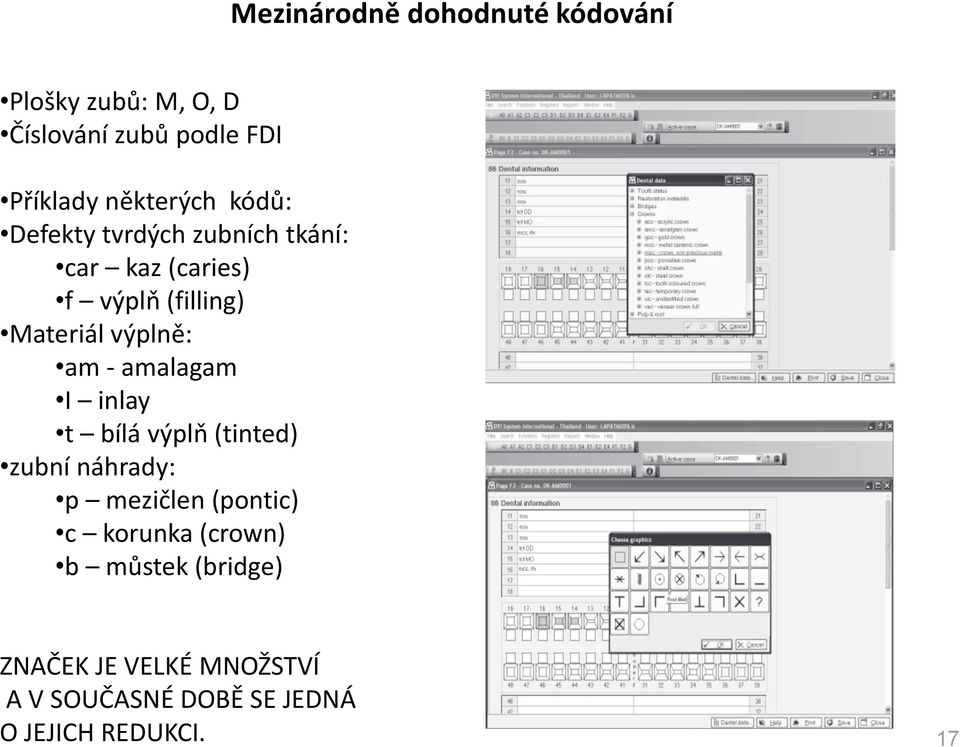 výplně: am - amalagam I inlay t bílá výplň (tinted) zubní náhrady: p mezičlen (pontic) c