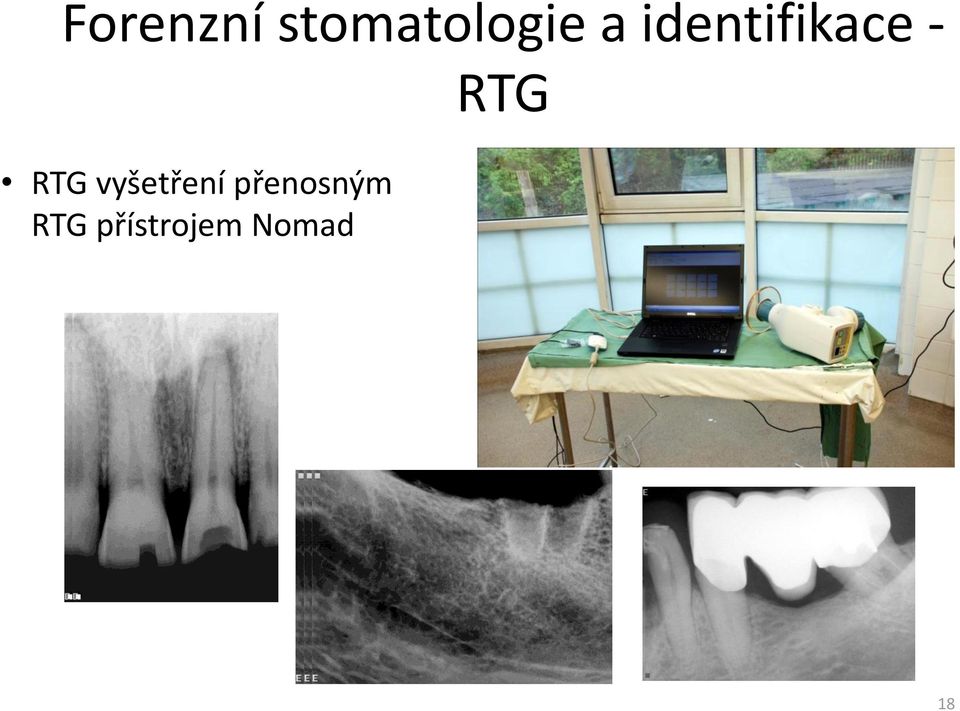 vyšetření přenosným