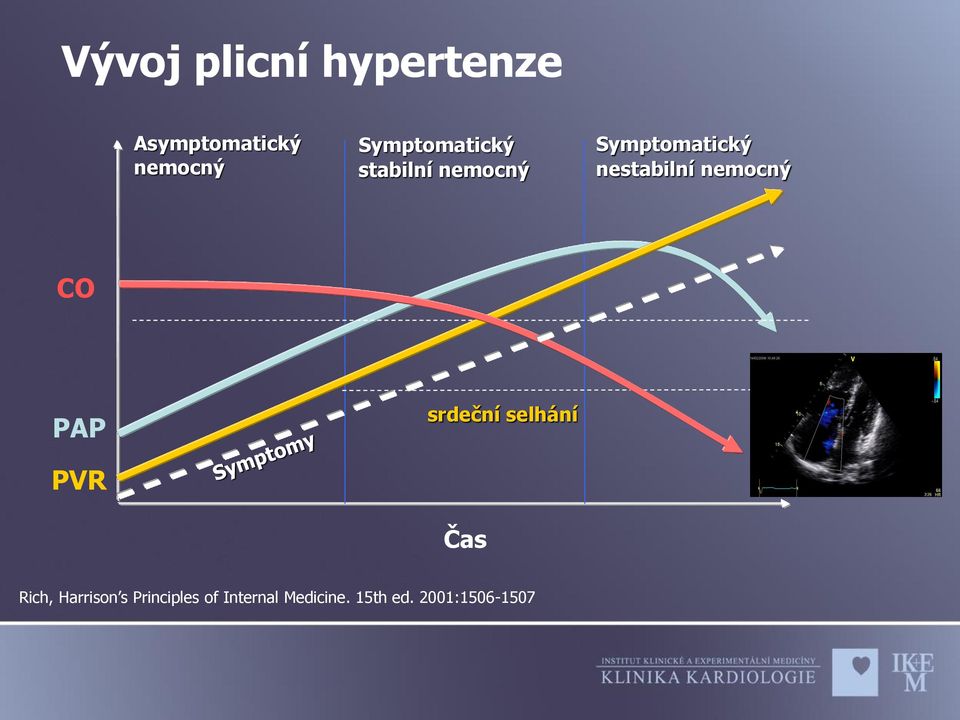 nestabilní nemocný CO PAP srdeční selhání PVR Čas