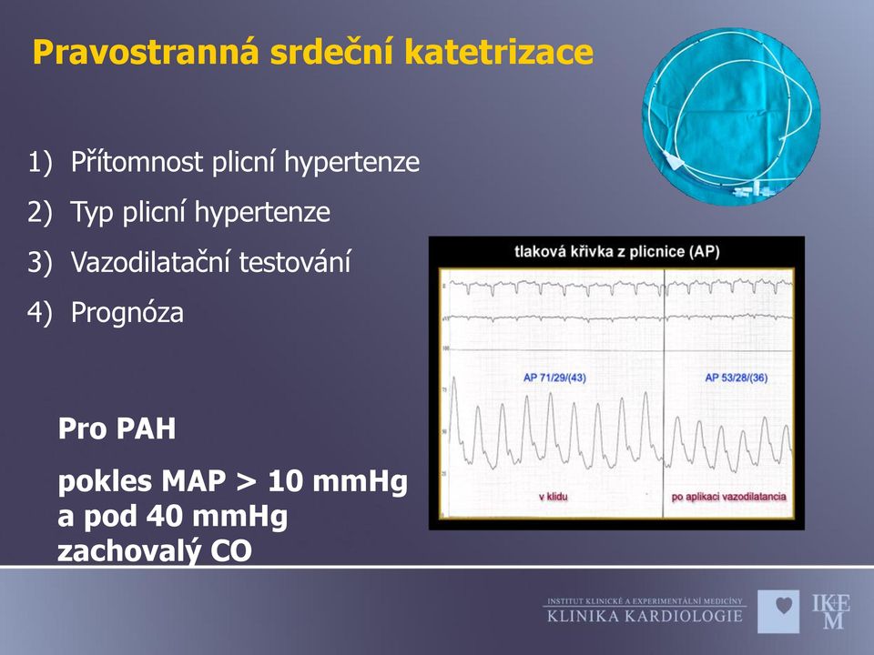 hypertenze 3) Vazodilatační testování 4)