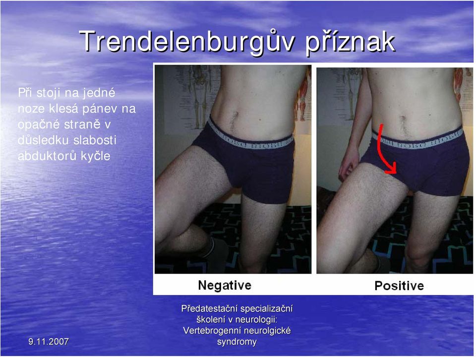 pánev na opačné straně v