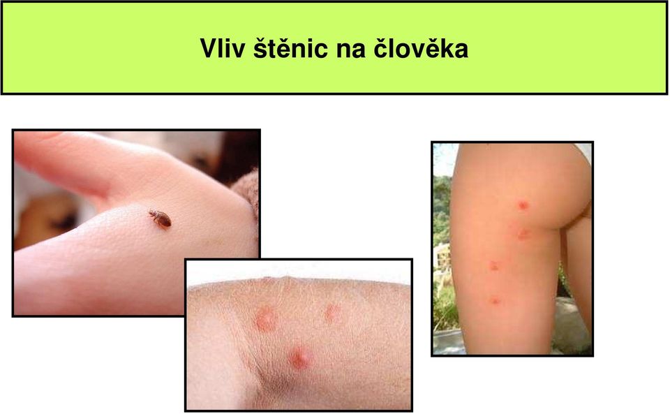 člověka