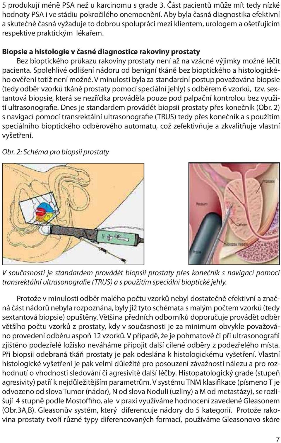 Biopsie a histologie v časné diagnostice rakoviny prostaty Bez bioptického průkazu rakoviny prostaty není až na vzácné výjimky možné léčit pacienta.