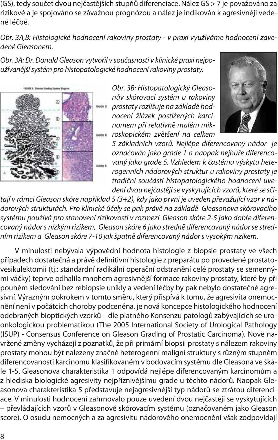 Donald Gleason vytvořil v současnosti v klinické praxi nejpoužívanější systém pro histopatologické hodnocení rakoviny prostaty. Obr.