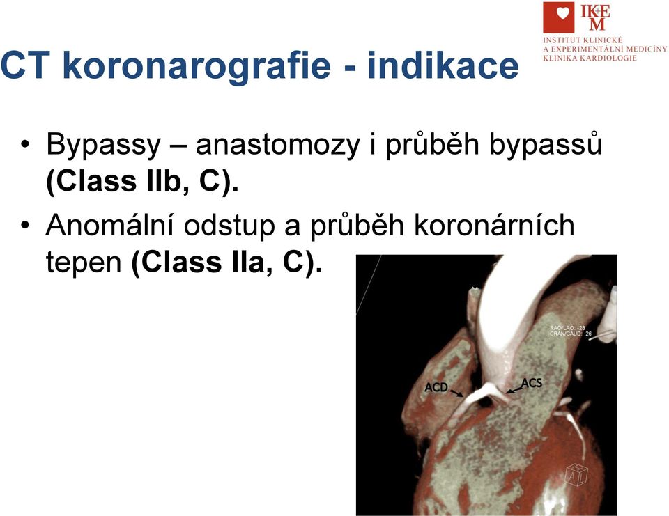 bypassů (Class IIb, C).
