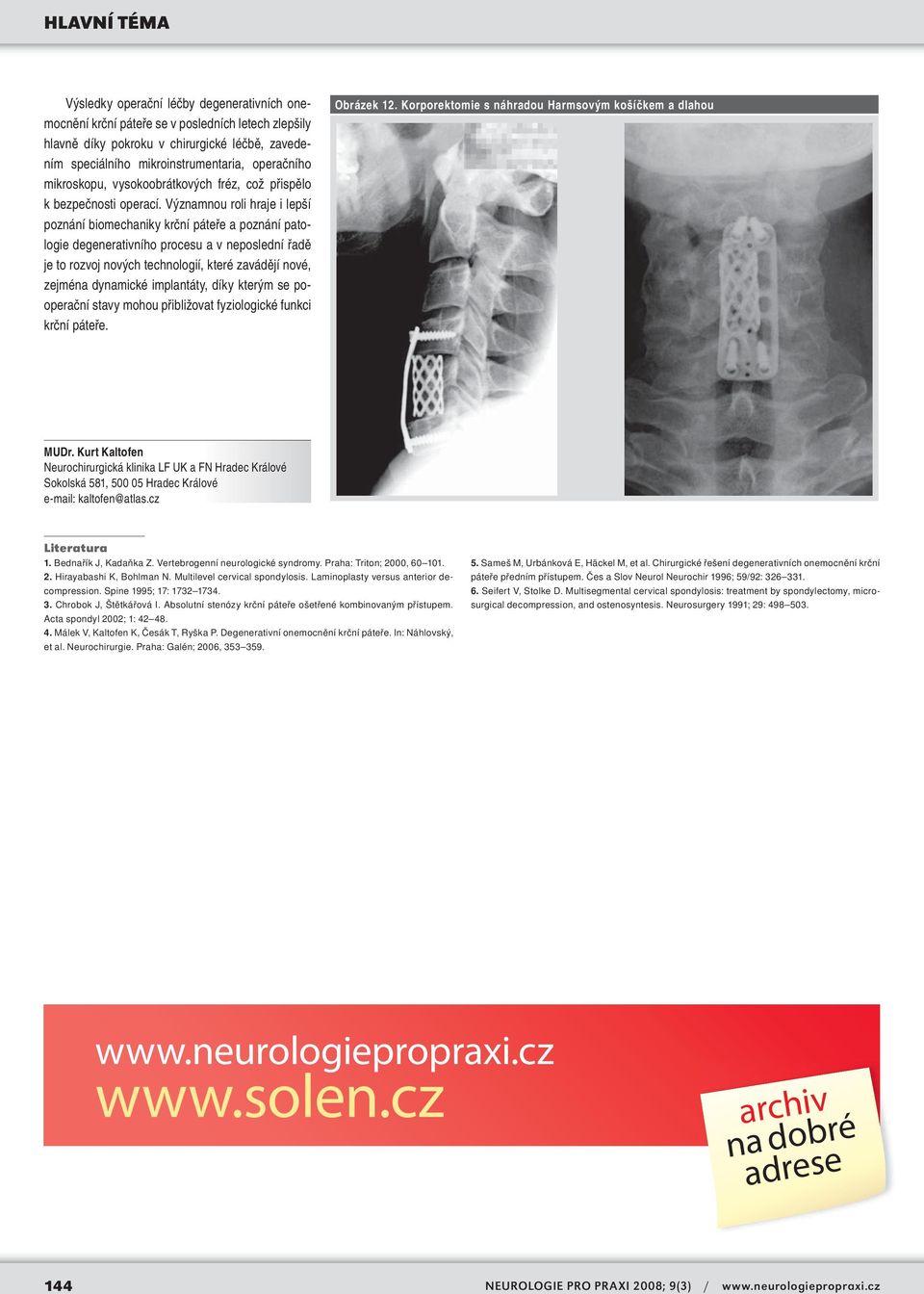 Významnou roli hraje i lepší poznání biomechaniky krční páteře a poznání patologie degenerativního procesu a v neposlední řadě je to rozvoj nových technologií, které zavádějí nové, zejména dynamické