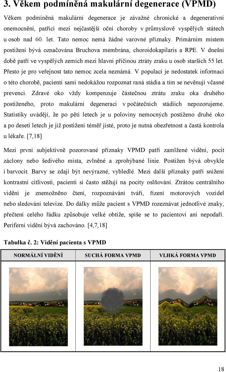 V dnešní době patří ve vyspělých zemích mezi hlavní příčinou ztráty zraku u osob starších 55 let. Přesto je pro veřejnost tato nemoc zcela neznámá.