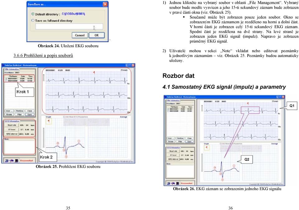 Okno se zobrazeným EKG záznamem je rozděleno na horní a dolní část. V horní části je zobrazen celý 15-ti sekundový EKG záznam. Spodní část je rozdělena na dvě strany.