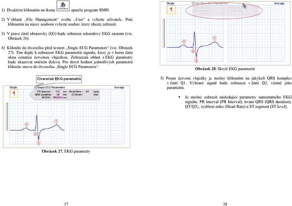 Tím dojde k zobrazení EKG parametrů signálu, který je v horní části okna označen červenou vlaječkou. Zobrazená oblast s EKG parametry bude ukazovat směrem doleva.