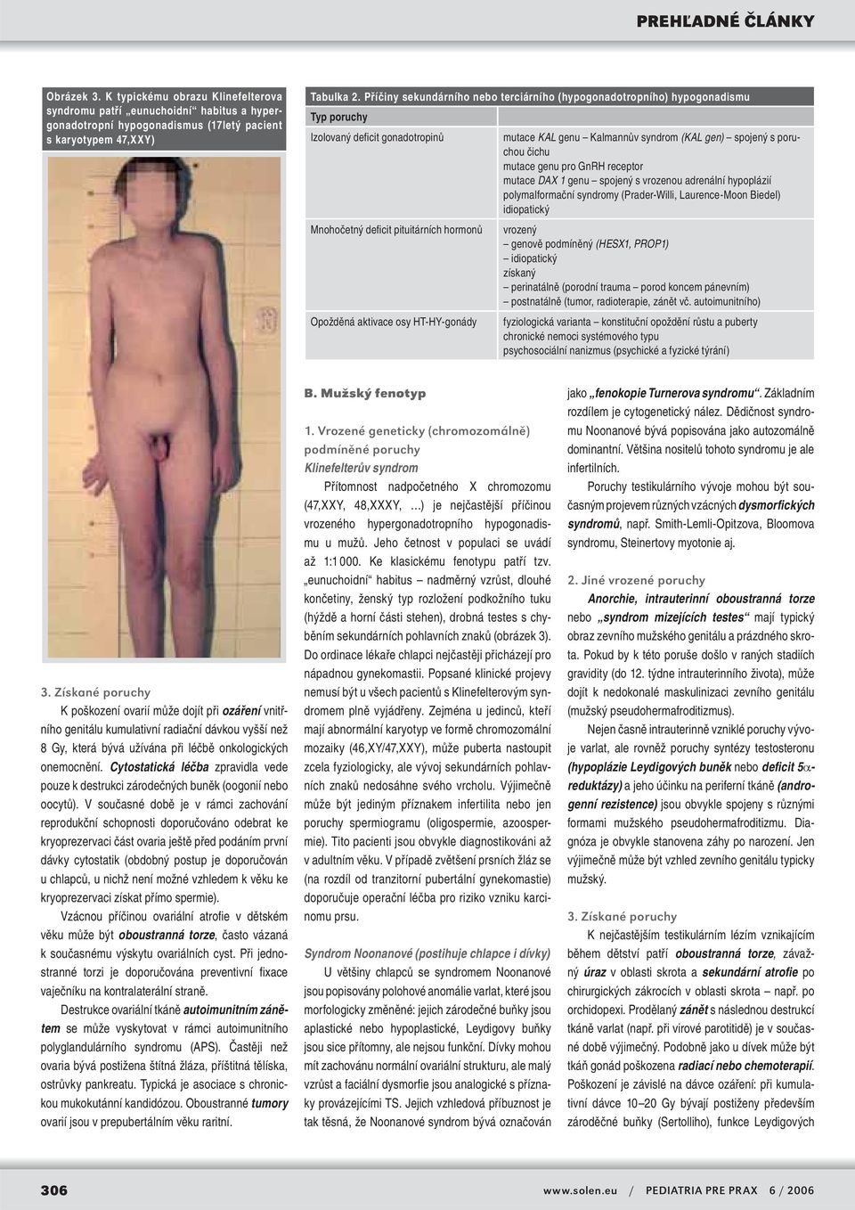 pro GnRH receptor mutace DAX 1 genu spojený s vrozenou adrenální hypoplázií polymalformační syndromy (Prader-Willi, Laurence-Moon Biedel) idiopatický Mnohočetný deficit pituitárních hormonů vrozený