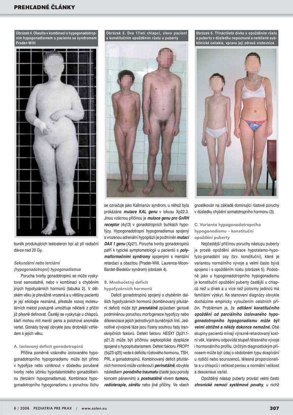 Sekundární nebo terciární (hypogonadotropní) hypogonadismus Porucha tvorby gonadotropinů se může vyskytovat samostatně, nebo v kombinaci s chyběním jiných hypofyzárních hormonů (tabulka 2).