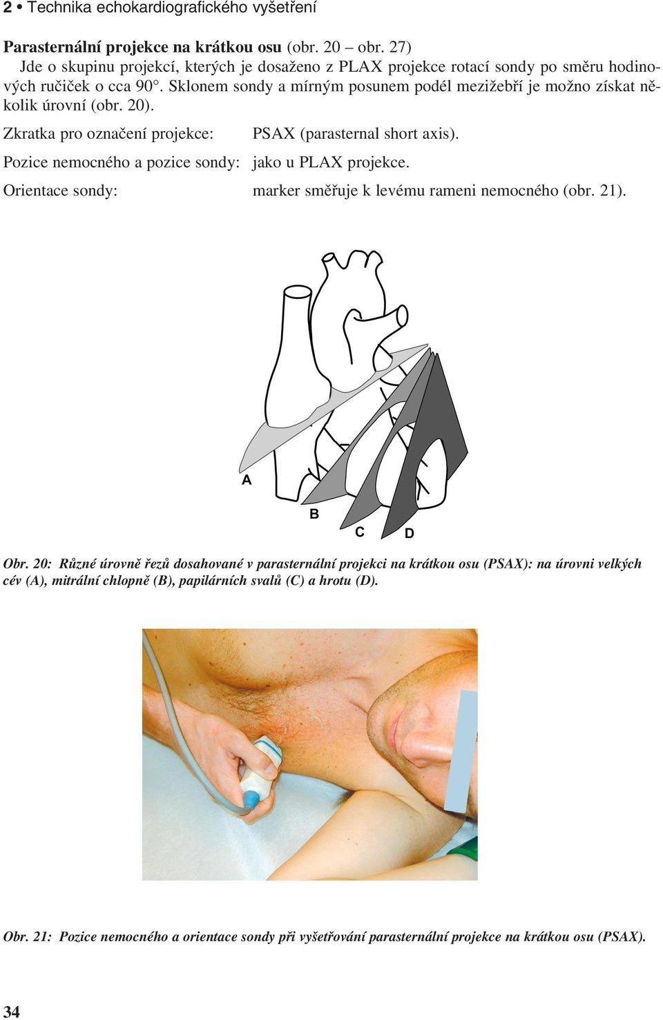 Sklonem sondy a mírným posunem podél mezižebří je možno získat několik úrovní (obr. 20). Zkratka pro označení projekce: PSAX (parasternal short axis).