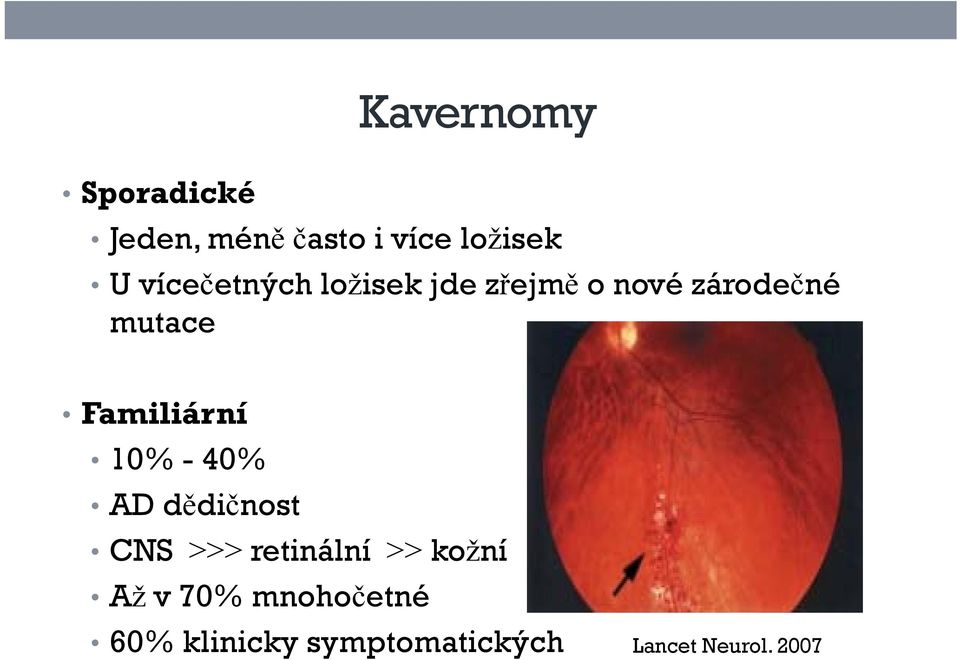 Familiární 10% - 40% AD dědičnost CNS retinální kožní Až