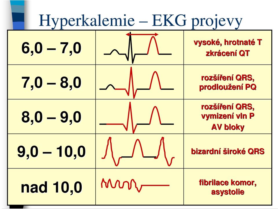 QRS, prodloužen ení PQ rozší šíření QRS, vymizení vln P