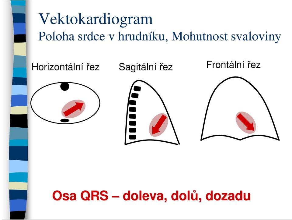 Horizontální řez Sagitální řez