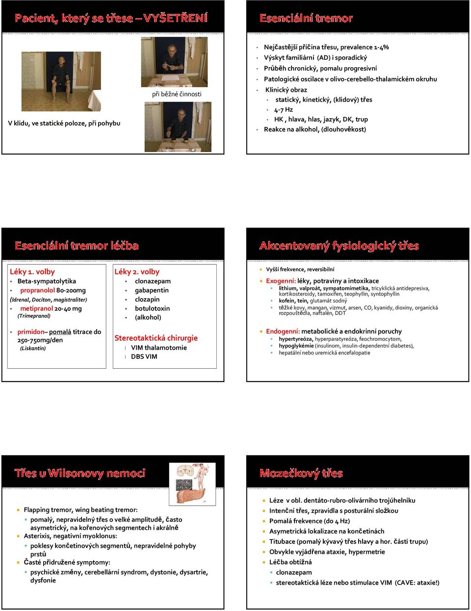 volby Beta-sympatolytika propranolol 80-200mg (Idrenal, Dociton, magistraliter) metipranol20-40 mg (Trimepranol) primidon pomalátitrace do 250-750mg/den (Liskantin) Léky 2.