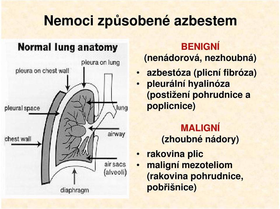 pohrudnice a poplicnice) MALIGNÍ (zhoubné nádory)