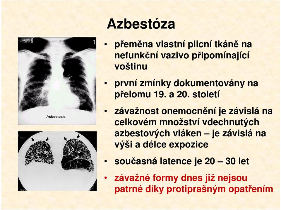 století závažnost onemocnění je závislá na celkovém množství vdechnutých azbestových