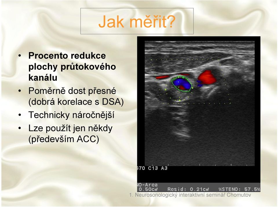 dost přesné (dobrá korelace s DSA) Technicky