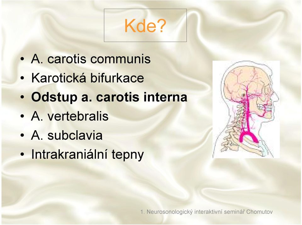 Odstup a. carotis interna A. vertebralis A.