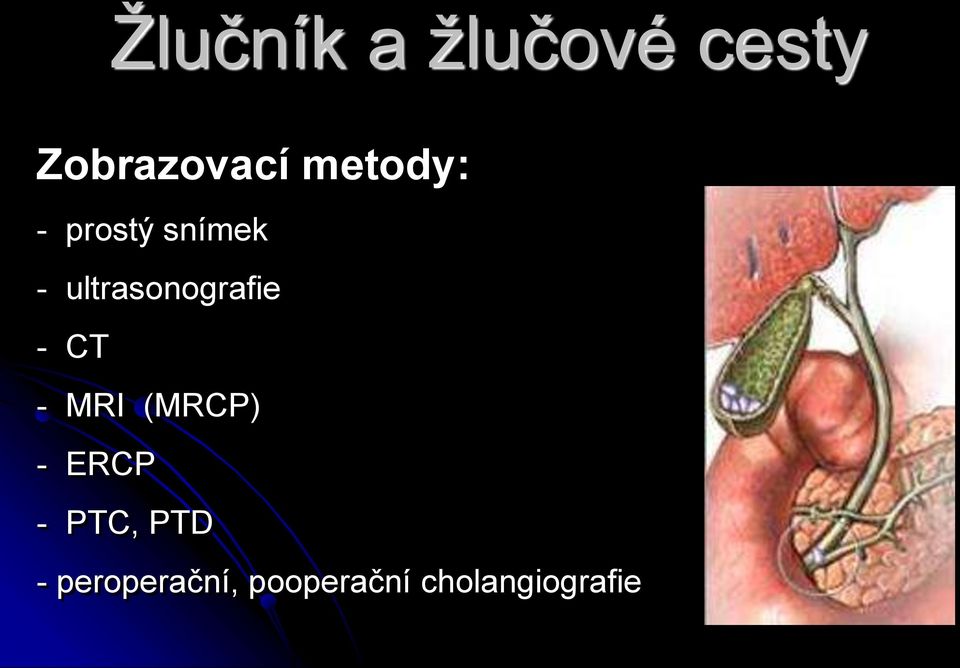 ultrasonografie - CT - MRI (MRCP) -