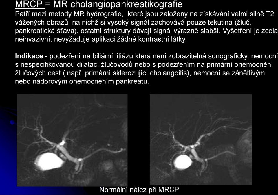 Vyšetření je zcela neinvazivní, nevyžaduje aplikaci žádné kontrastní látky.