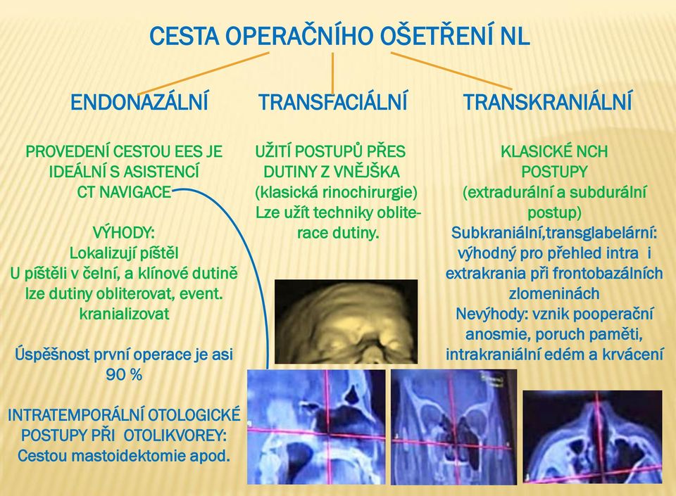 kranializovat Úspěšnost první operace je asi 90 % INTRATEMPORÁLNÍ OTOLOGICKÉ POSTUPY PŘI OTOLIKVOREY: Cestou mastoidektomie apod.