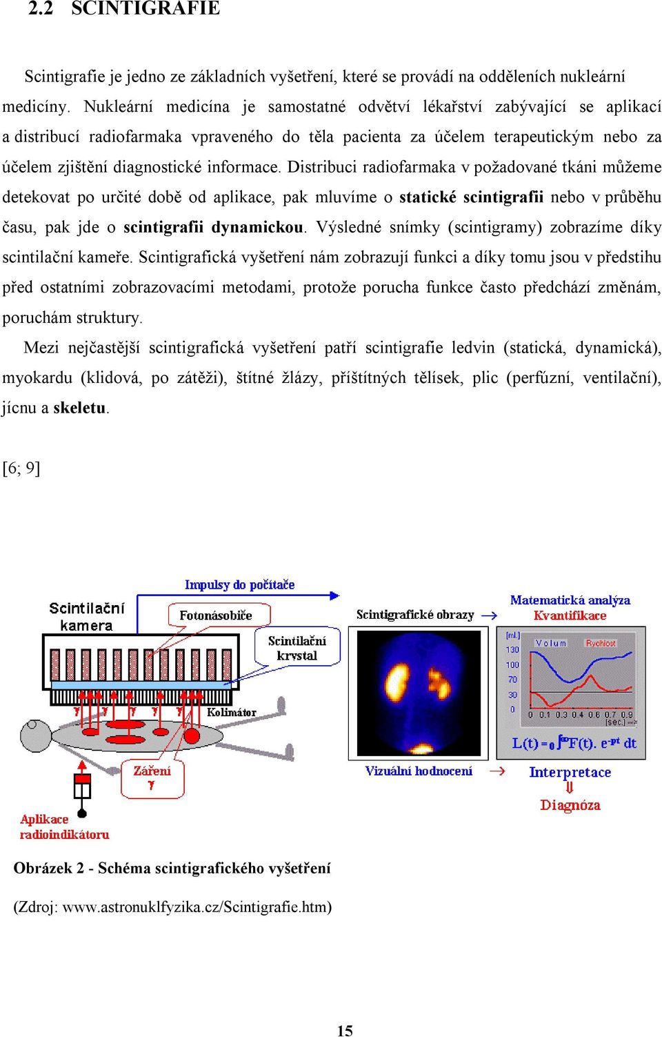 Distribuci radiofarmaka v požadované tkáni můžeme detekovat po určité době od aplikace, pak mluvíme o statické scintigrafii nebo v průběhu času, pak jde o scintigrafii dynamickou.