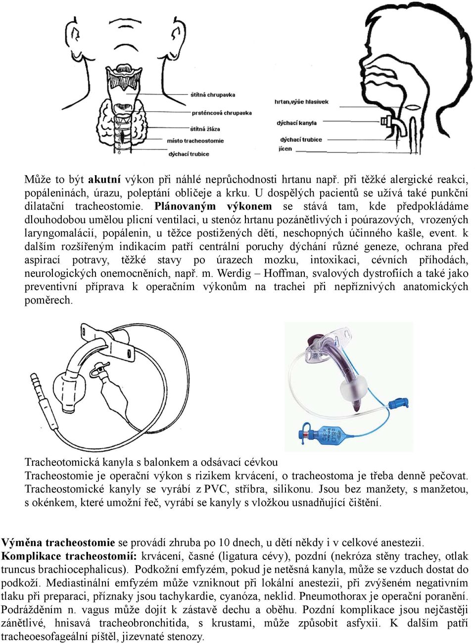 Plánovaným výkonem se stává tam, kde předpokládáme dlouhodobou umělou plicní ventilaci, u stenóz hrtanu pozánětlivých i poúrazových, vrozených laryngomalácií, popálenin, u těžce postižených dětí,