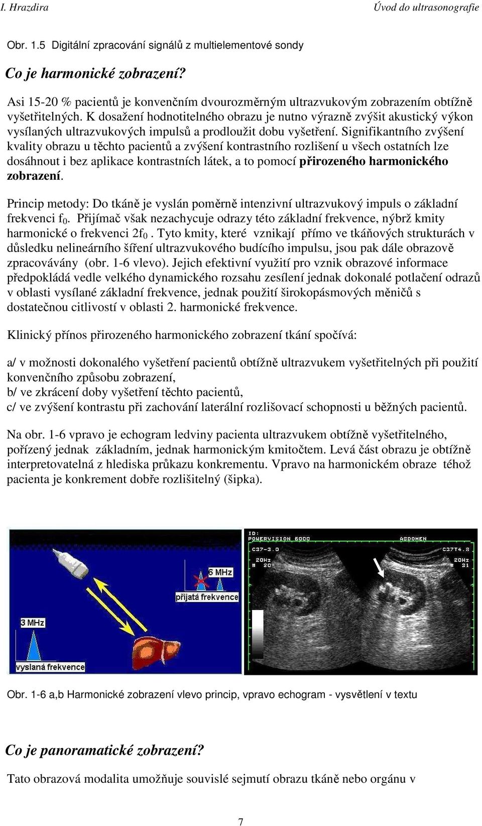 Signifikantního zvýšení kvality obrazu u těchto pacientů a zvýšení kontrastního rozlišení u všech ostatních lze dosáhnout i bez aplikace kontrastních látek, a to pomocí přirozeného harmonického