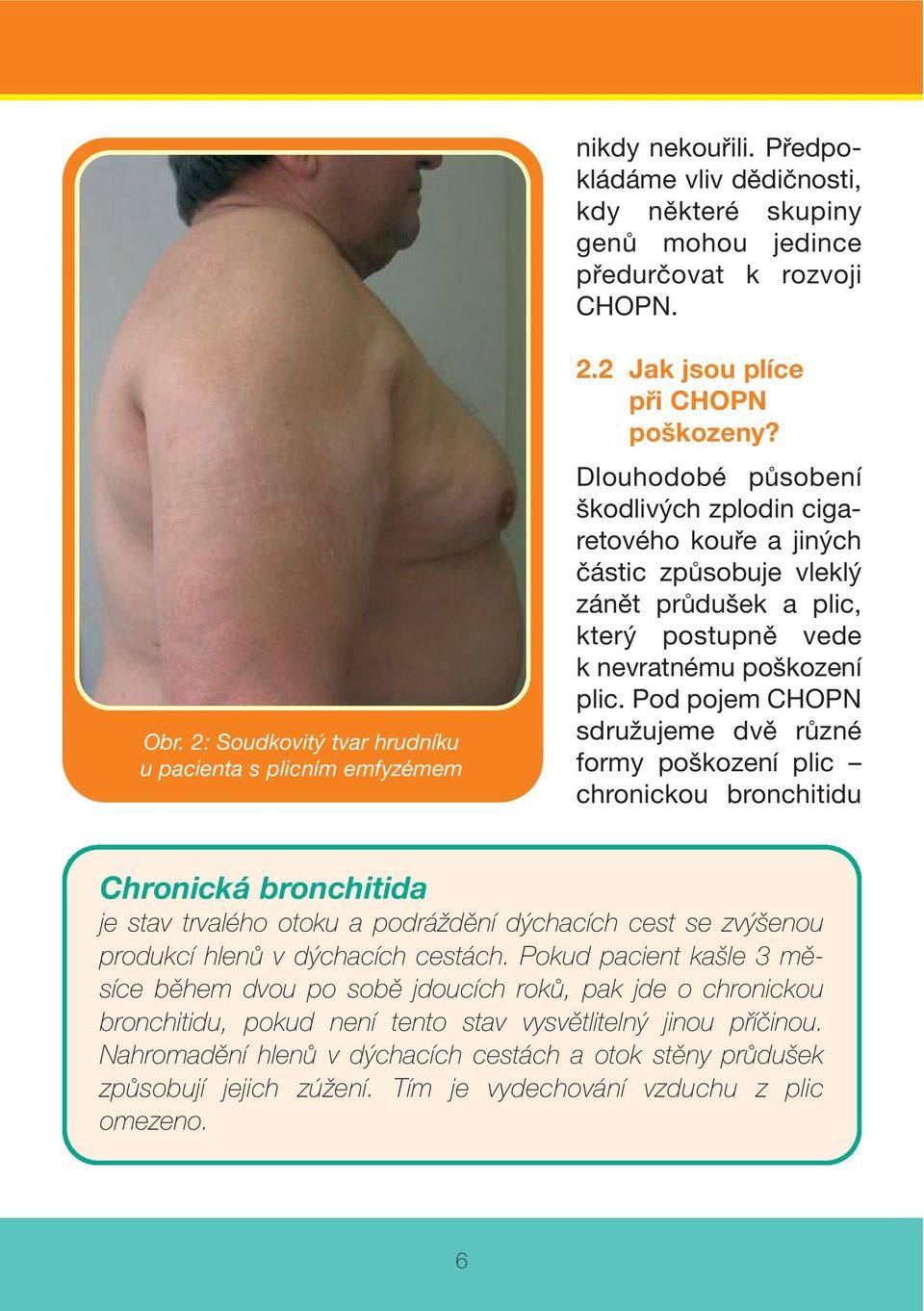 Pod pojem CHOPN sdružujeme dvě různé formy poškození plic chronickou bronchitidu Chronická bronchitida je stav trvalého otoku a podráždění dýchacích cest se zvýšenou produkcí hlenů v dýchacích