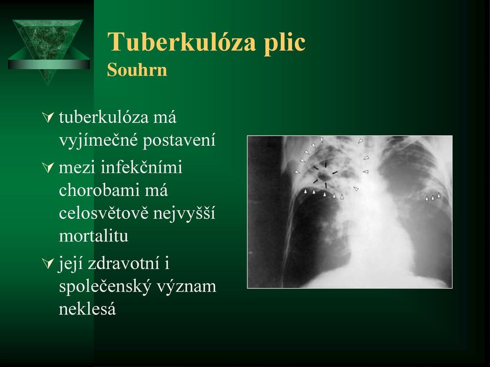 chorobami má celosvětově nejvyšší