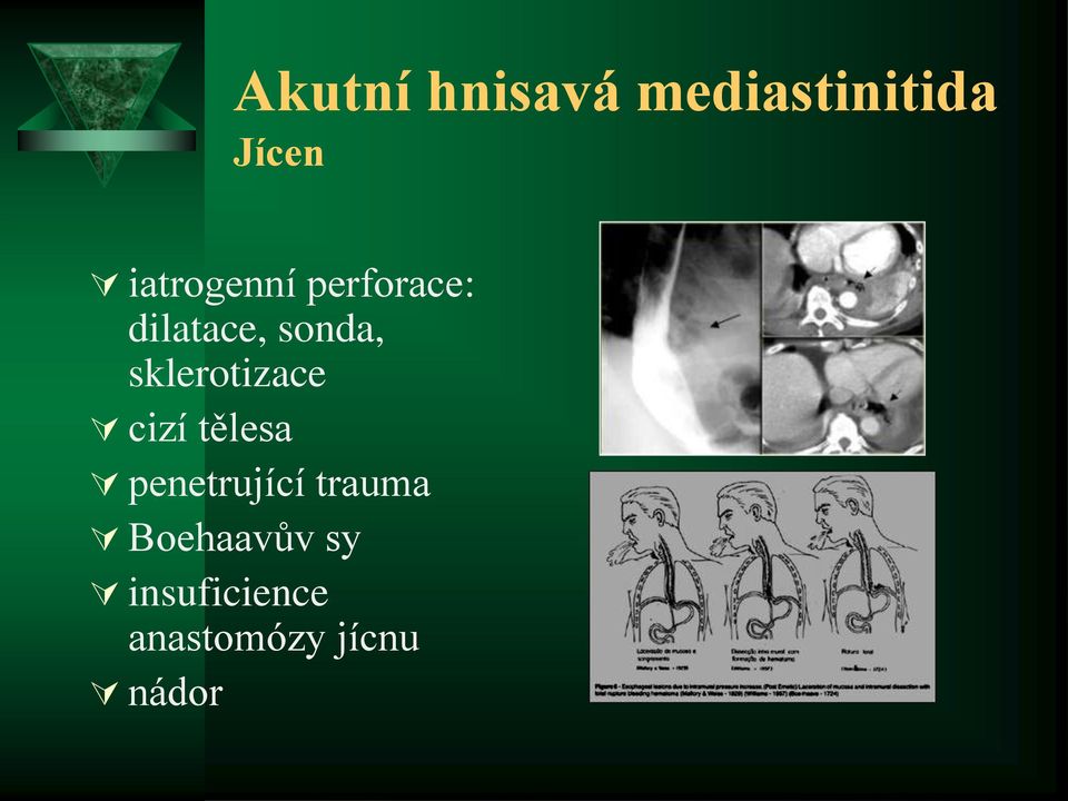 sklerotizace cizí tělesa penetrující