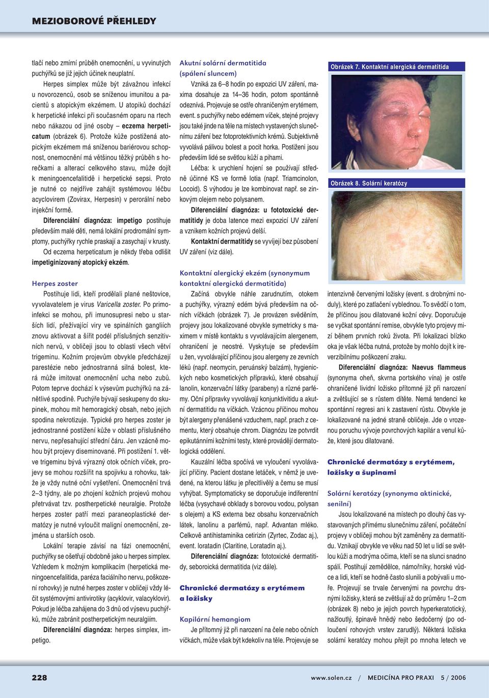 U atopiků dochází k herpetické infekci při současném oparu na rtech nebo nákazou od jiné osoby eczema herpeticatum (obrázek 6).