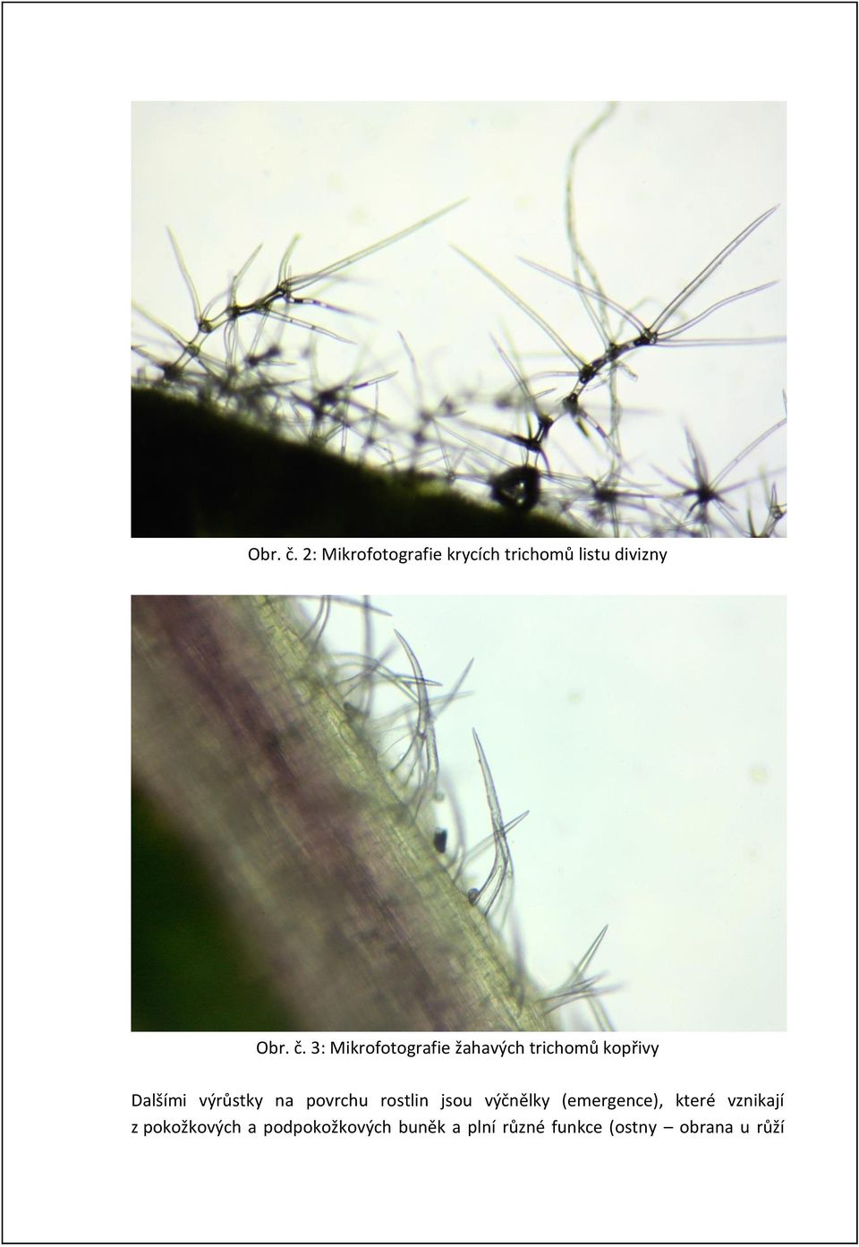 Mikrofotografie žahavých trichomů kopřivy Dalšími výrůstky na