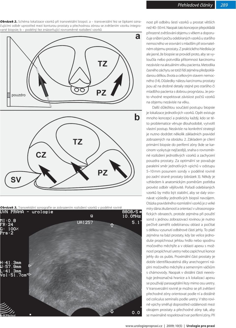Obrázek 3. Transrektální sonografie se zobrazením rozložení vzorků v podélné rovině nost při odběru šesti vzorků u prostat větších než 40 50 ml.