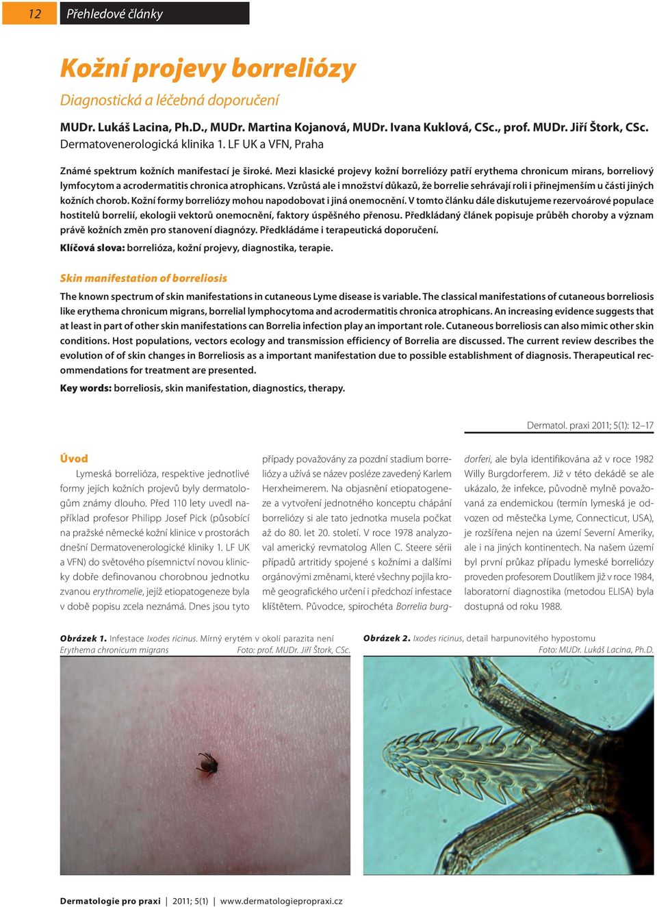Mezi klasické projevy kožní borreliózy patří erythema chronicum mirans, borreliový lymfocytom a acrodermatitis chronica atrophicans.