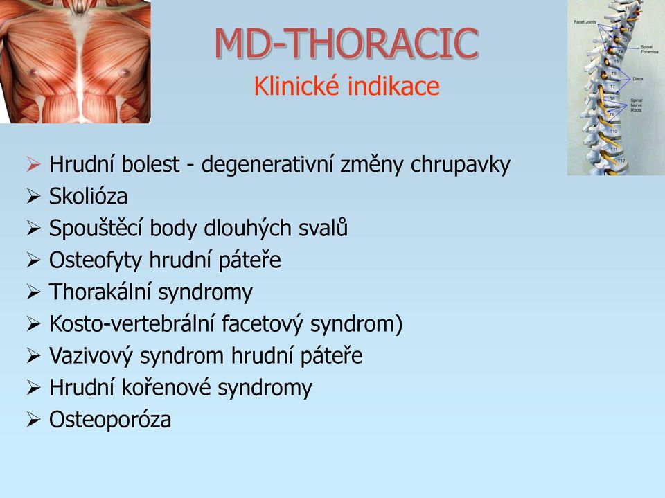 páteře Thorakální syndromy Kosto-vertebrální facetový syndrom)