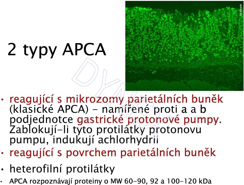 Zablokují-li tyto protilátky protonovu pumpu, indukují achlorhydrii reagující s