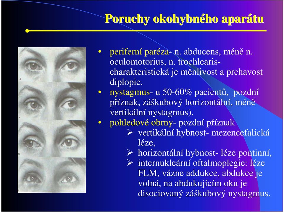 nystagmus- u 50-60% pacientů, pozdní příznak, záškubový horizontální, méně vertikální nystagmus).